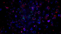 Representative fluorescent image of TP53-WT, KRAS-WT patient-derived organoids