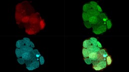 Representative confocal images of TP53-R175H-mutant patient-derived organoids treated with the Base Editing sgRNA